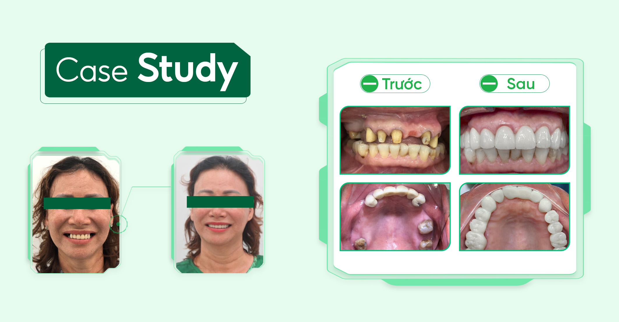 Case-boc-rang-sư (2)