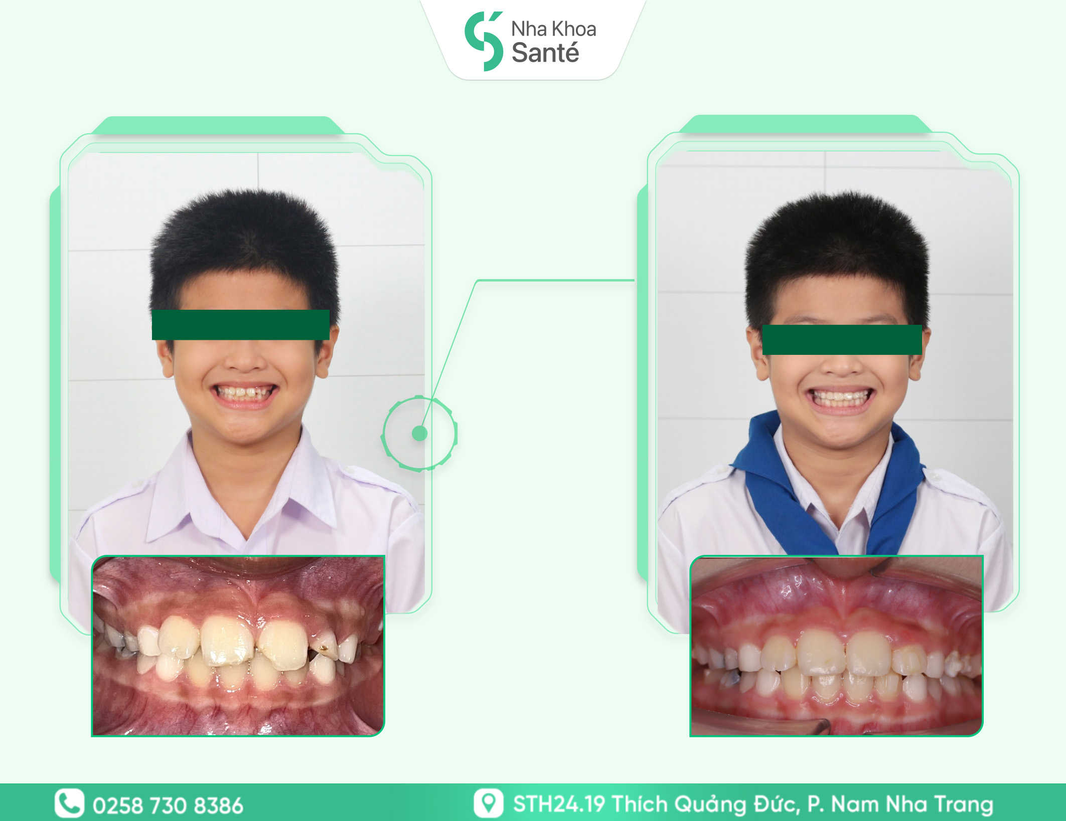 Ho&agrave;ng Ph&uacute;c Nguy&ecirc;n - Smartee